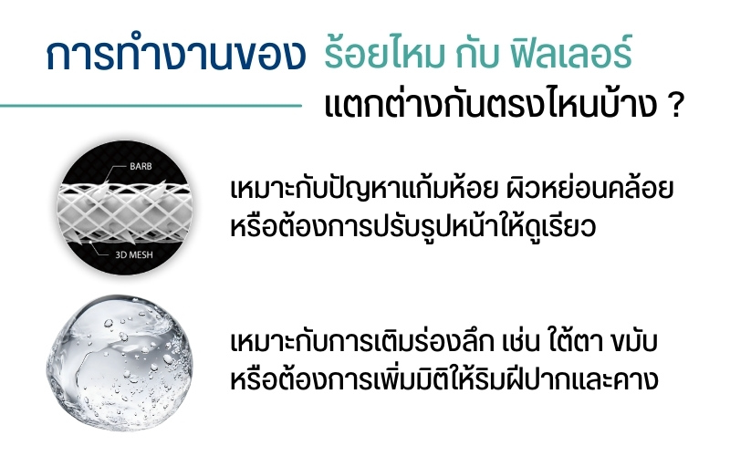 การทำงานของร้อยไหม กับ ฟิลเลอร์ แตกต่างกันตรงไหนบ้าง ?