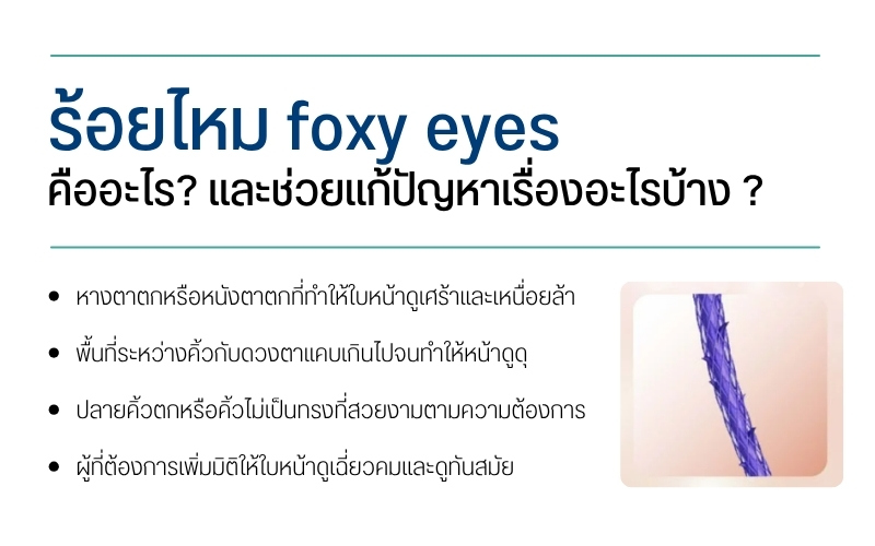 ร้อยไหม foxy eyes คืออะไร? และช่วยแก้ปัญหาเรื่องอะไรบ้าง ?