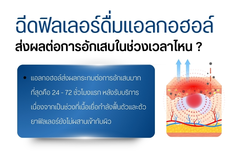 ฉีดฟิลเลอร์ดื่มแอลกอฮอล์ส่งผลต่อการอักเสบในช่วงเวลาไหน ?