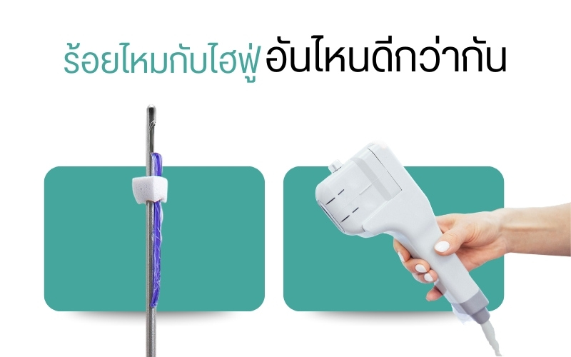 ร้อยไหมกับไฮฟูอันไหนดีกว่ากัน