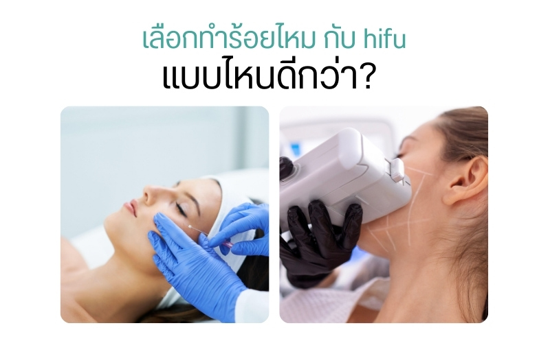 เลือกทำร้อยไหม กับ hifu แบบไหนดีกว่า