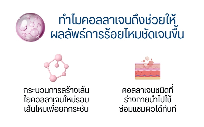 ทำไมคอลลาเจนถึงช่วยให้ผลลัพธ์การร้อยไหมชัดเจนขึ้น
