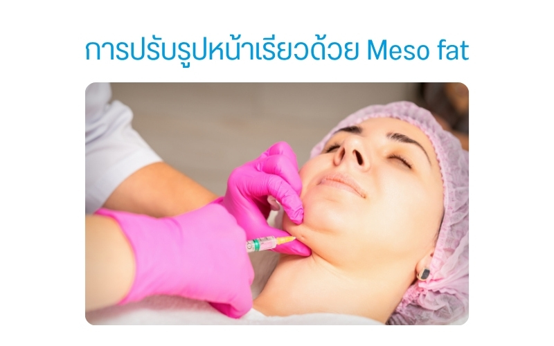 การปรับรูปหน้าเรียวด้วย Meso fat