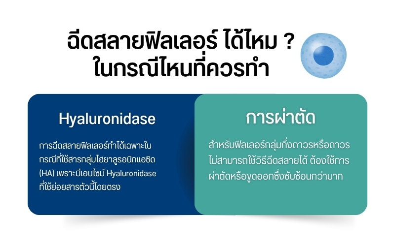 ฉีดสลายฟิลเลอร์ ได้ไหม ? ในกรณีไหนที่ควรทำ