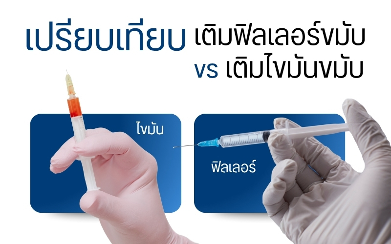 เปรียบเทียบ เติมฟิลเลอร์ขมับ vs เติมไขมันขมับ แบบไหนตอบโจทย์กว่ากัน ?