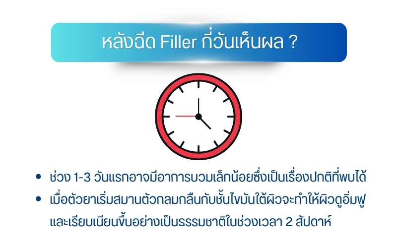 หลังฉีด Filler กี่วันเห็นผล ? และวิธีดูแลตัวเองอย่างถูกต้อง