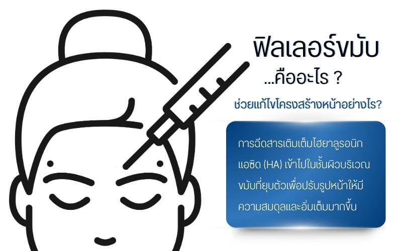 ฟิลเลอร์ขมับ คืออะไร ? ช่วยแก้ไขโครงสร้างหน้าได้อย่างไร