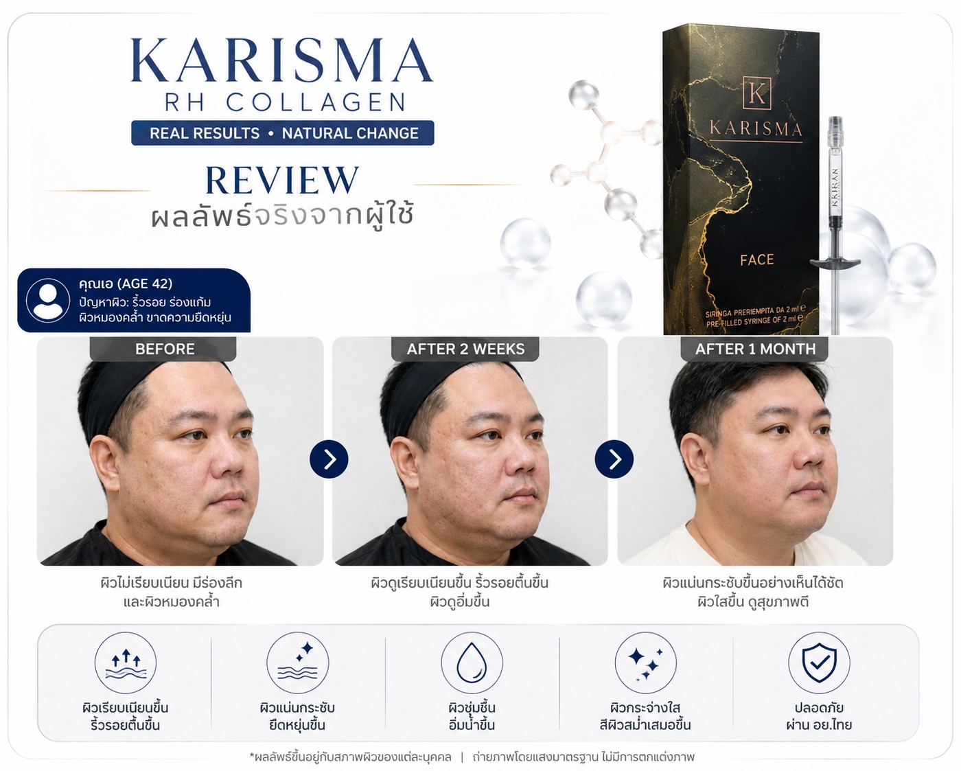 Karisma review
