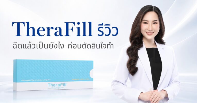 TheraFill รีวิว ฉีดแล้วเป็นยังไง ก่อนตัดสินใจทำ