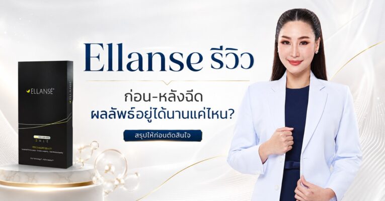 Ellanse รีวิว ก่อน-หลังฉีด ผลลัพธ์อยู่ได้นานแค่ไหน?