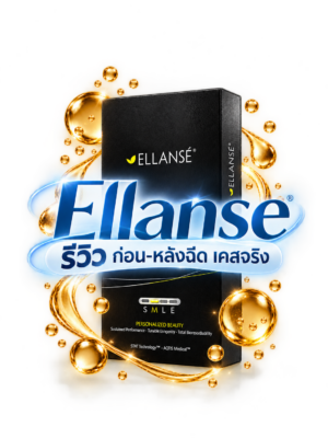 Ellanse รีวิว ก่อน-หลังฉีด