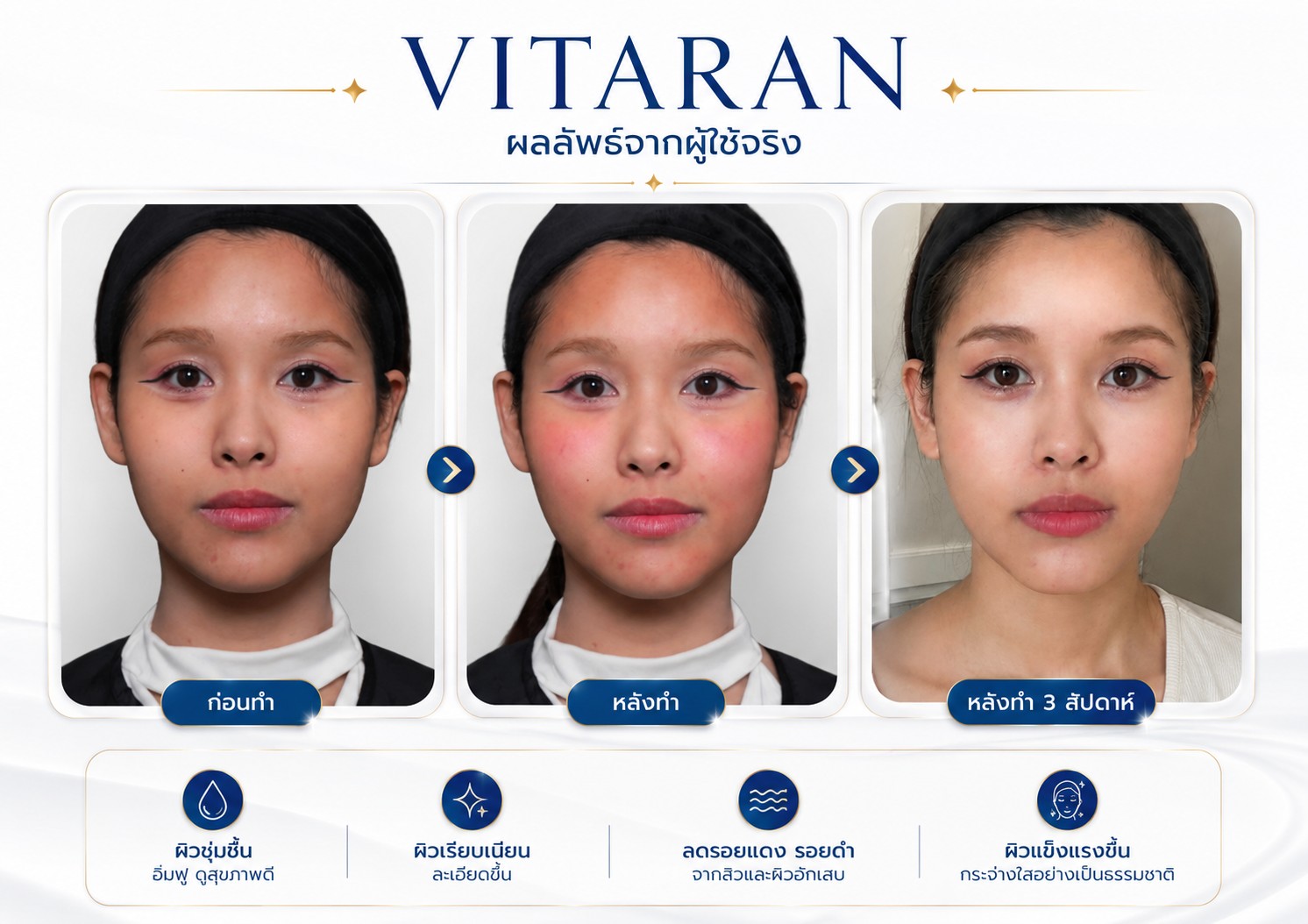 Vitaran รีวิว
