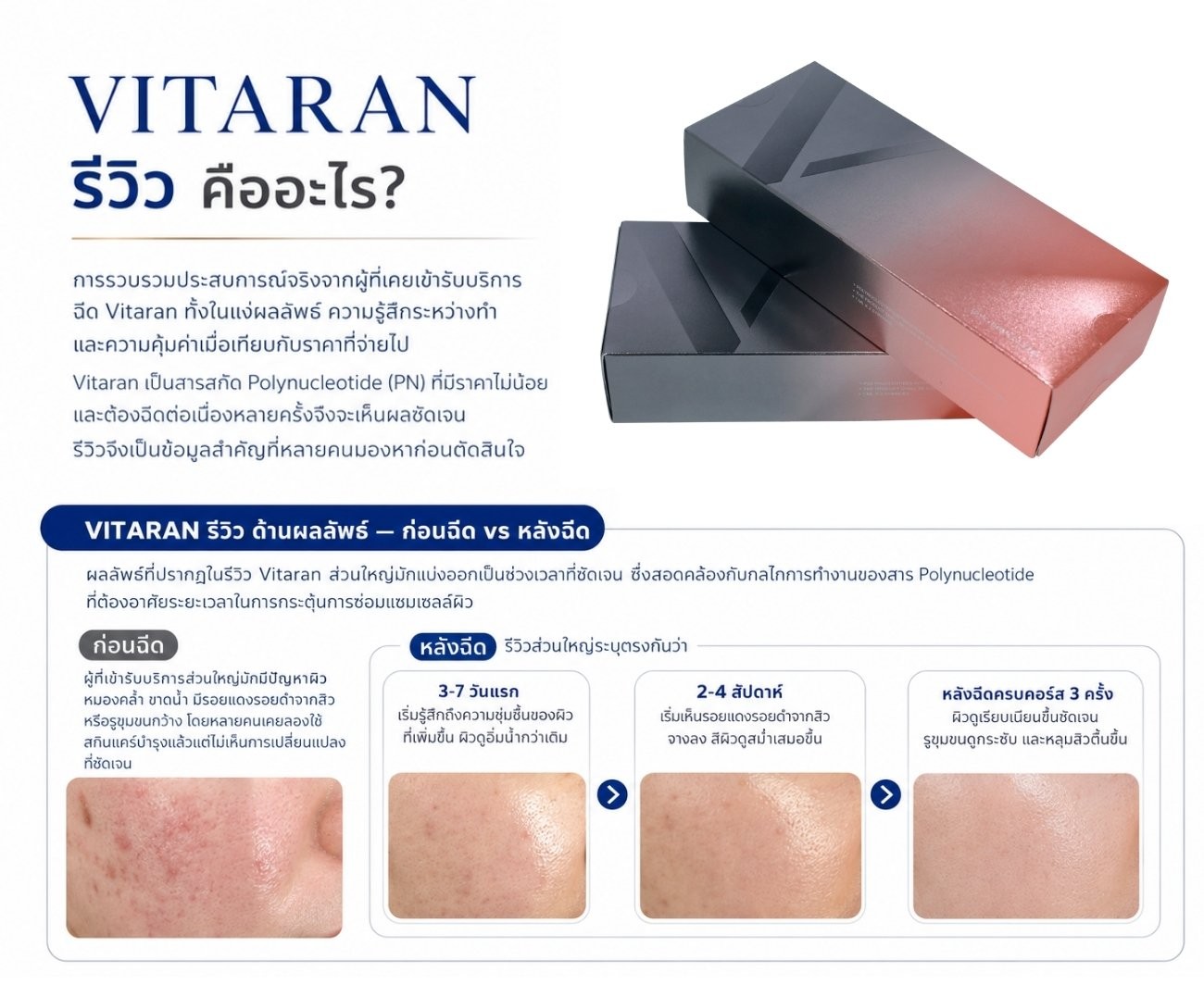 Vitaran รีวิว คืออะไร?
