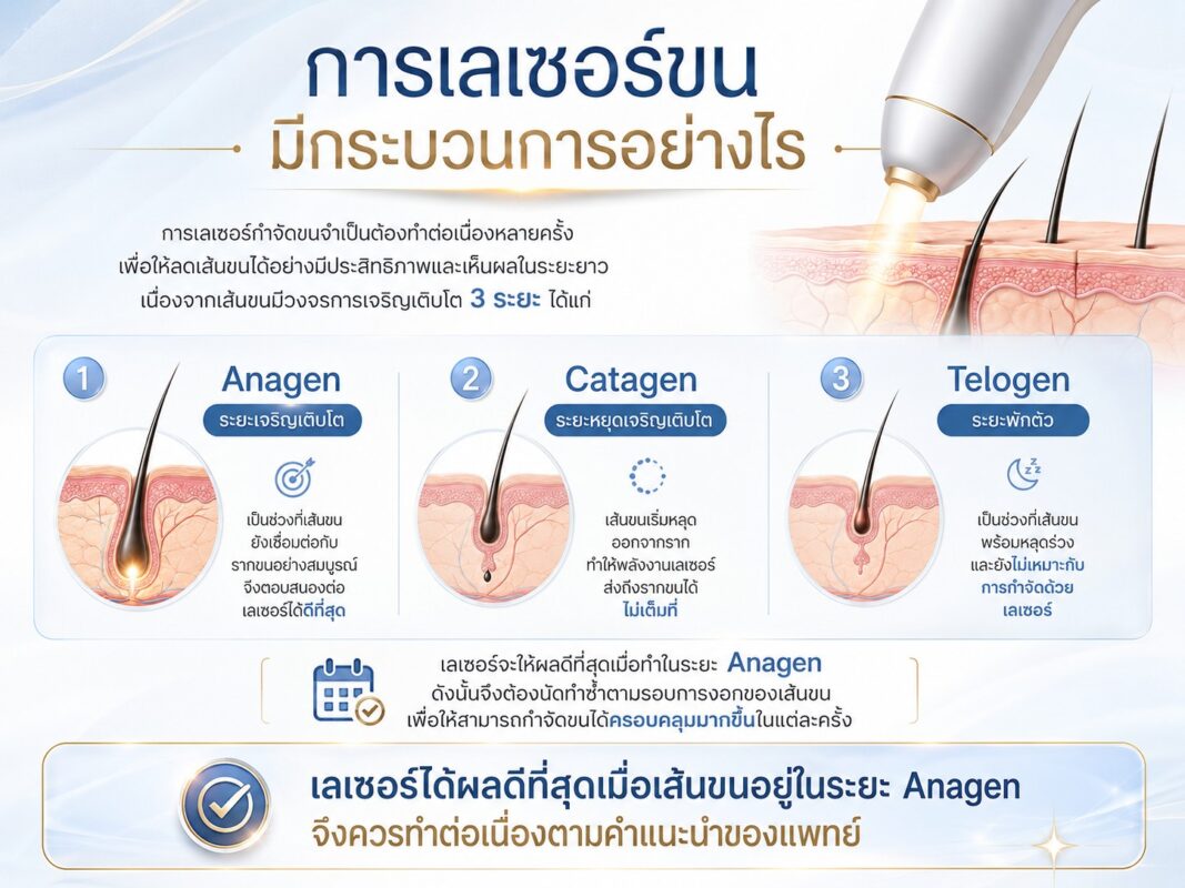 การเลเซอร์ขน มีกระบวนการอย่างไร