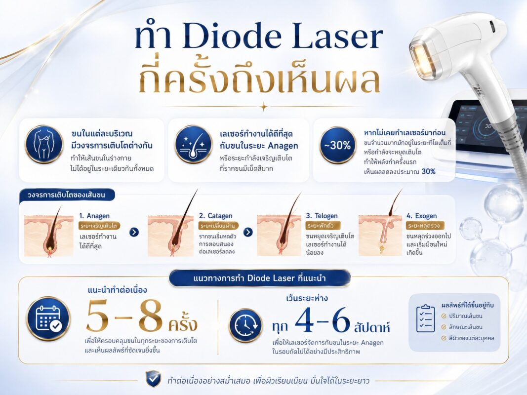 ทำ Diode Laser กี่ครั้งถึงเห็นผล