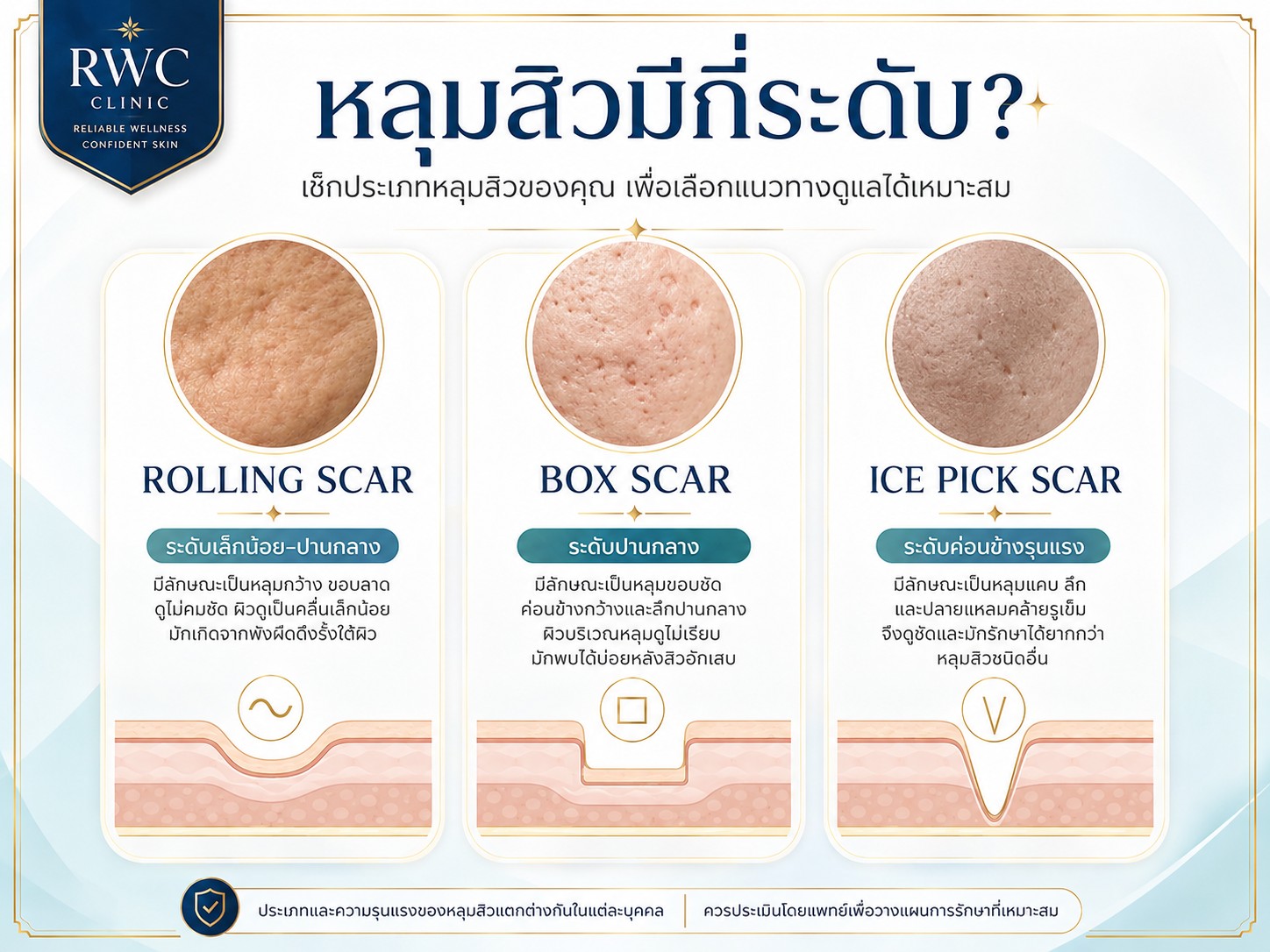 FRACTORA เหมาะกับการ รักษาหลุมสิว แบบใดได้บ้าง