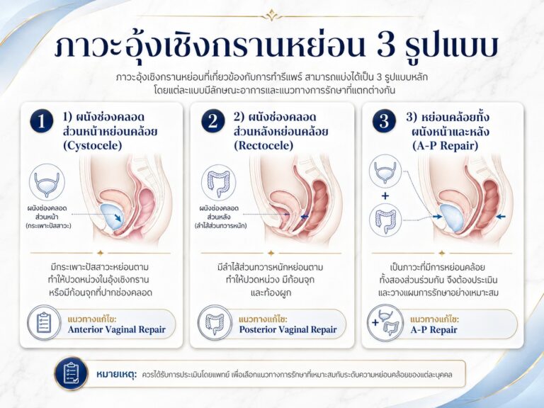 ภาวะอุ้งเชิงกรานหย่อน 3 รูปแบบ