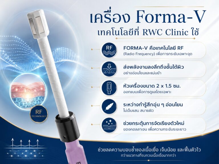 เครื่อง Forma-V เทคโนโลยีที่ RWC Clinic ใช้