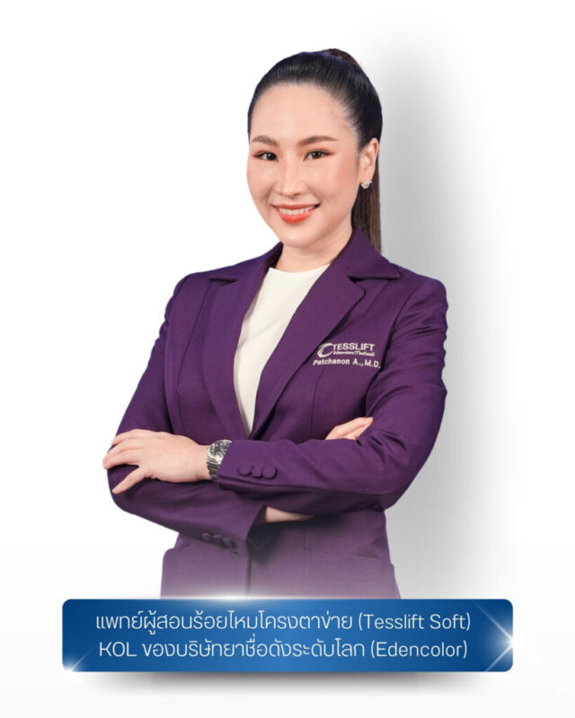 tesslift